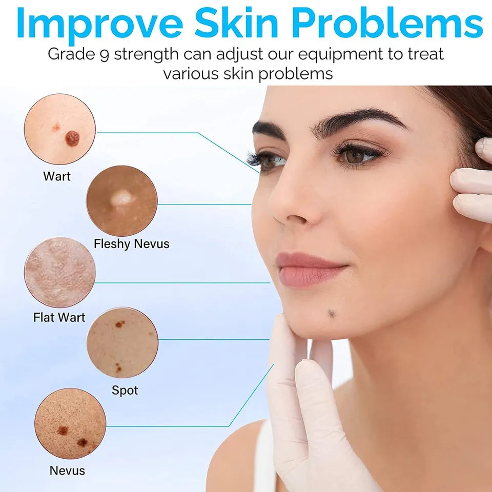 Plasma Pen To Remove Skin Tags, Moles And Warns