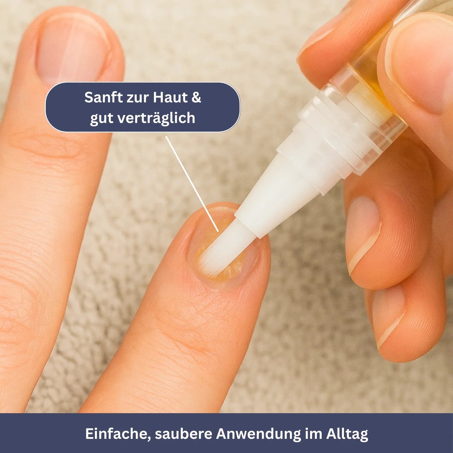 NailPen – Reparaturstift gegen Nagelpilz & Entzündungen