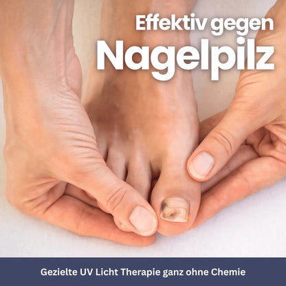 NailCare – Nagelpilztherapie mit UV-Licht