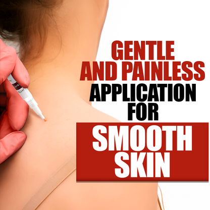 Painless Tags & Moles Remover – Easy & Effective Skin Treatment