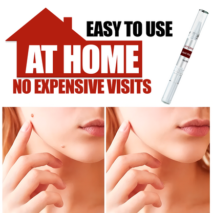 Painless Tags & Moles Remover – Easy & Effective Skin Treatment