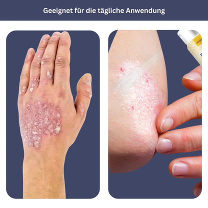 HOUKEA Bienengift Beruhigungsspray