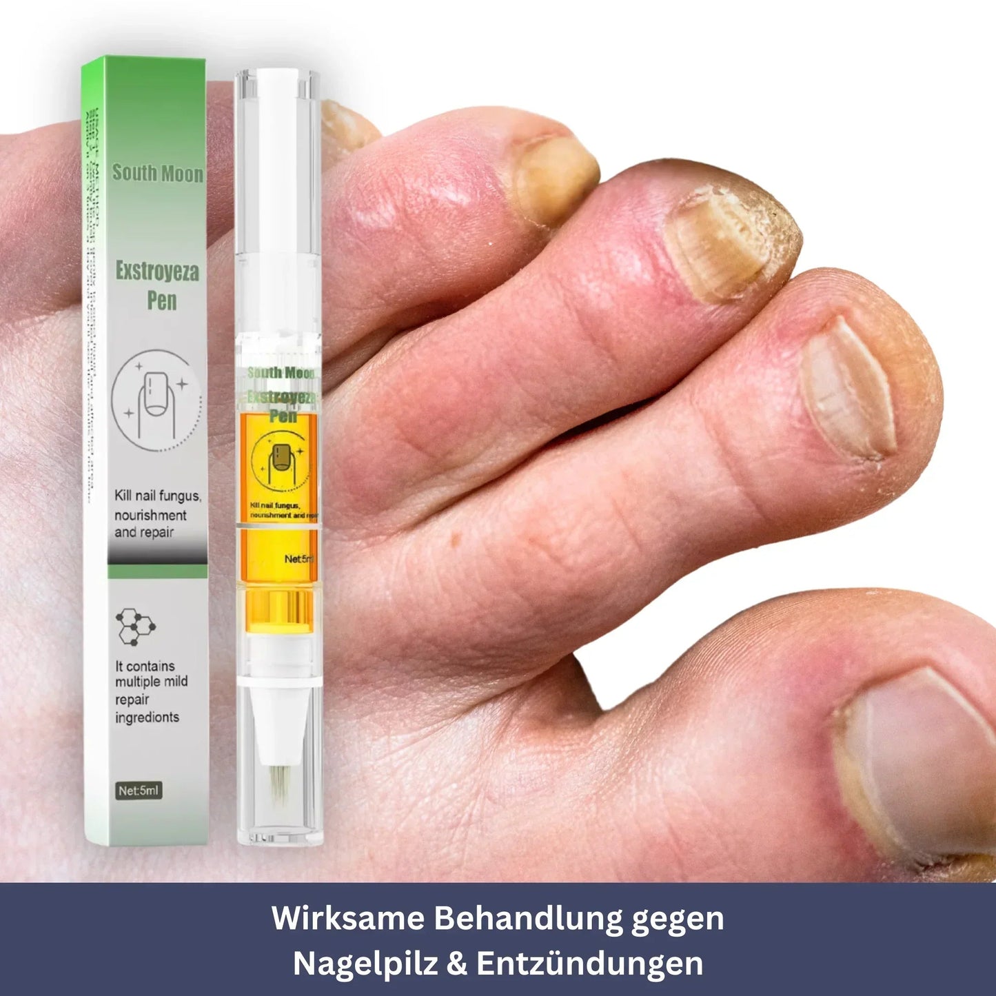 NailPen – Reparaturstift gegen Nagelpilz & Entzündungen
