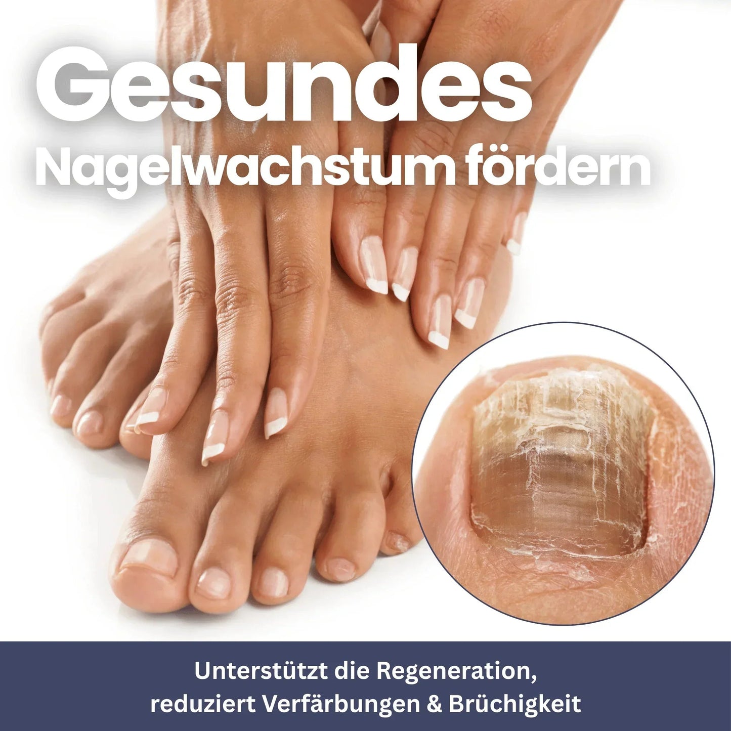 NailClip - Nagelpilztherapie-Gerät