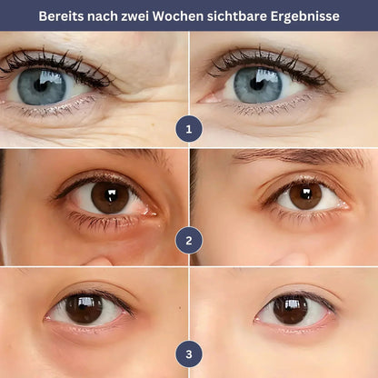 GlowEye – Dein Verjüngungs-Booster für strahlende Augen