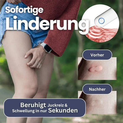 Elektronischer Anti-Juckreiz Stift – Sofortige Linderung bei Insektenstichen