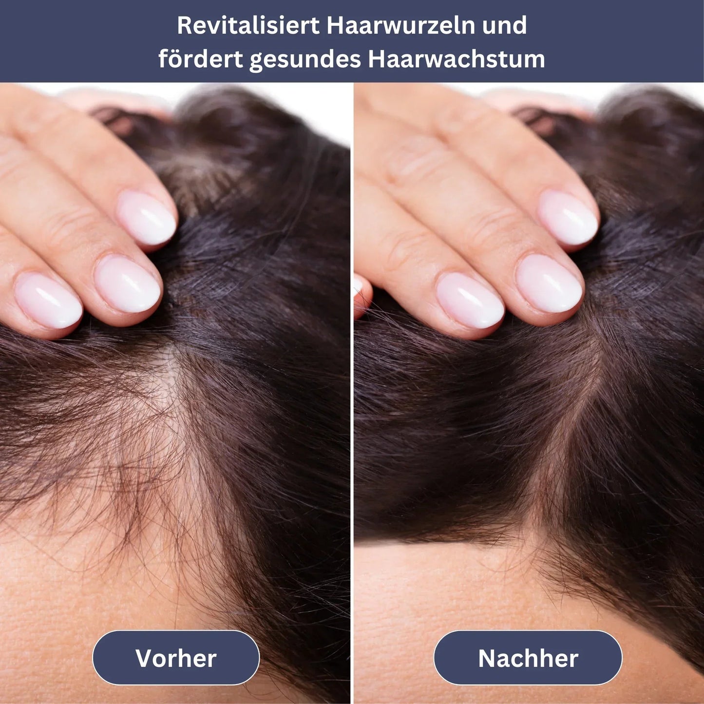 HaarVital Lichttherapie-Kappe