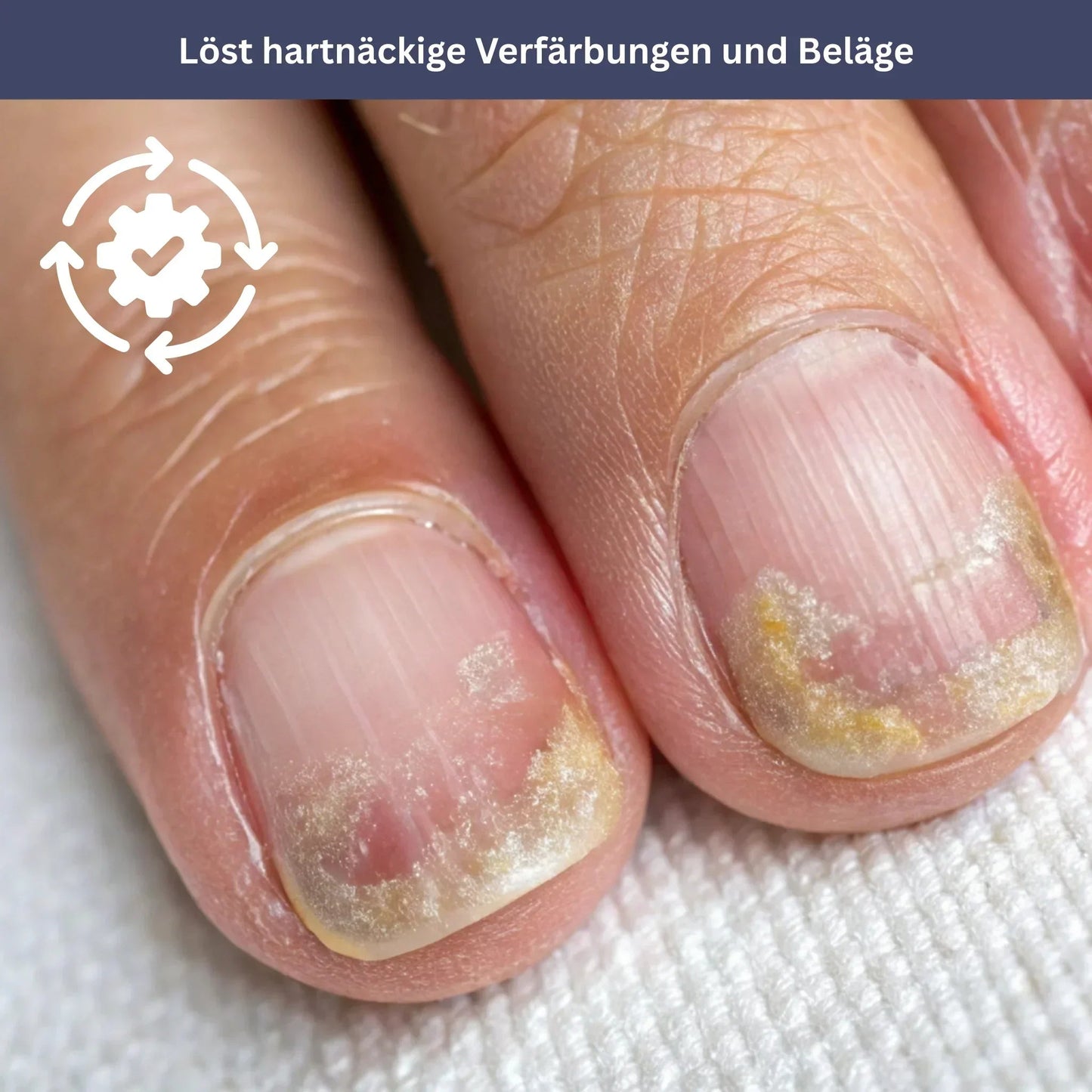NailDrops - Pflegeserum gegen Nagelpilz