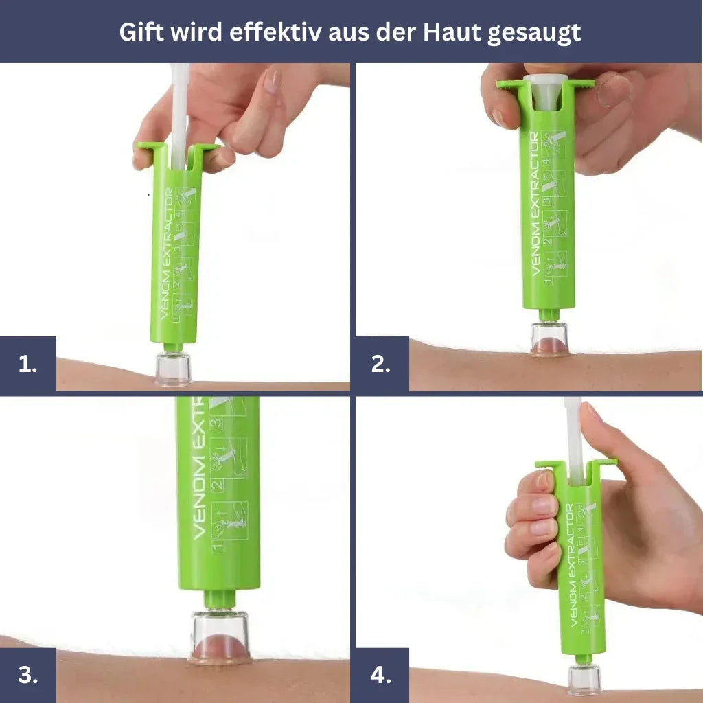 Anti Insekten Bundle - Stichheiler, Giftsauger, Mueckenarmband