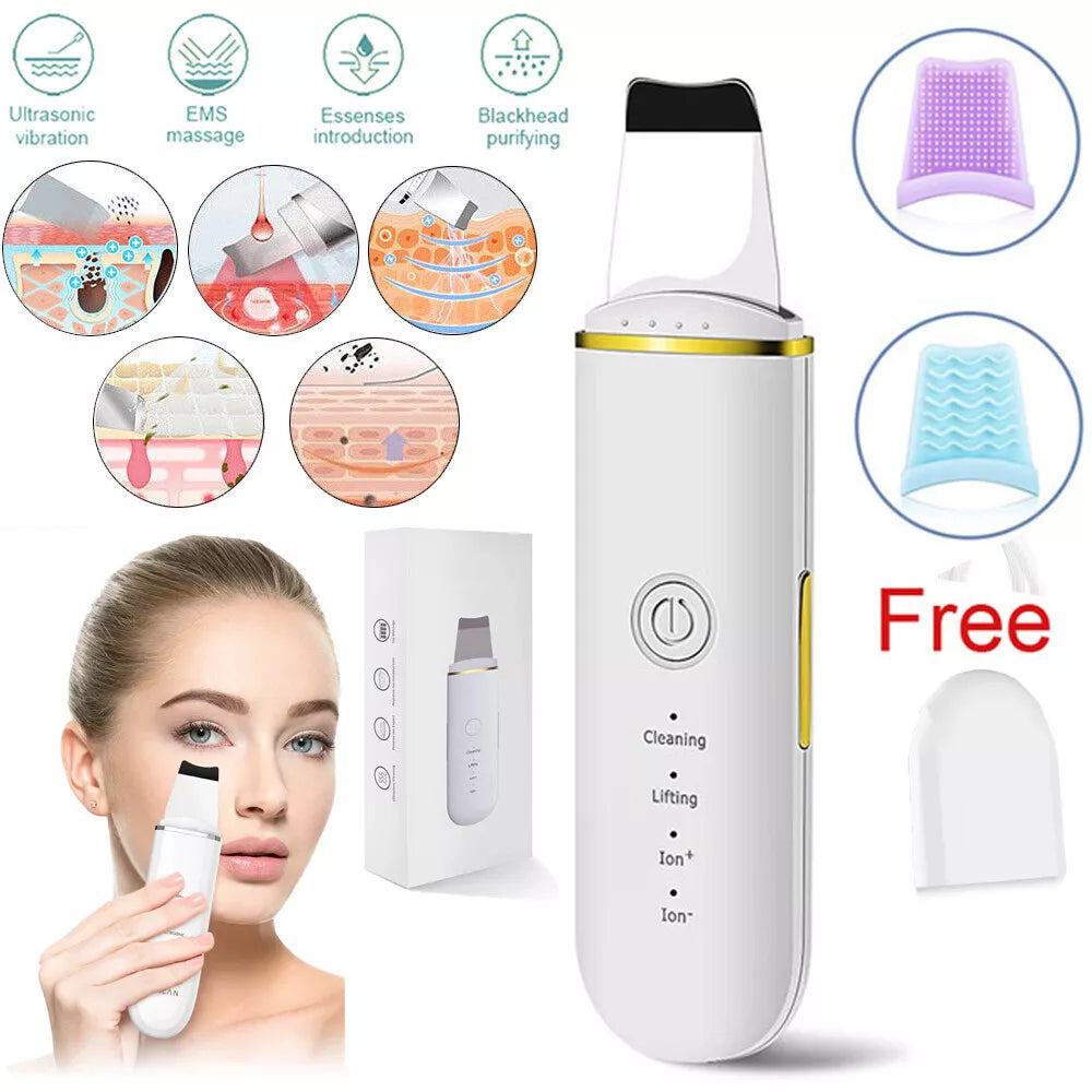 Ultrasonic Skin Scrubber Blackhead Remover – Deep Facial Cleansing & Exfoliation