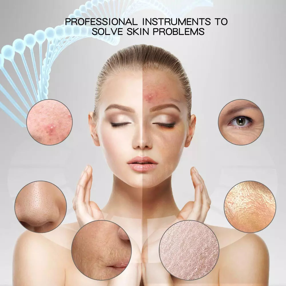 Ultrasonic Skin Scrubber Blackhead Remover – Deep Facial Cleansing & Exfoliation