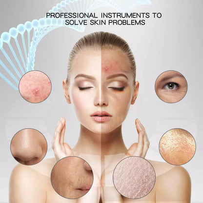 Ultrasonic Skin Scrubber Blackhead Remover – Deep Facial Cleansing & Exfoliation