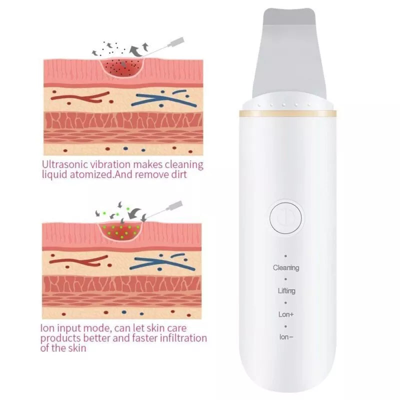 Ultrasonic Skin Scrubber Blackhead Remover – Deep Facial Cleansing & Exfoliation