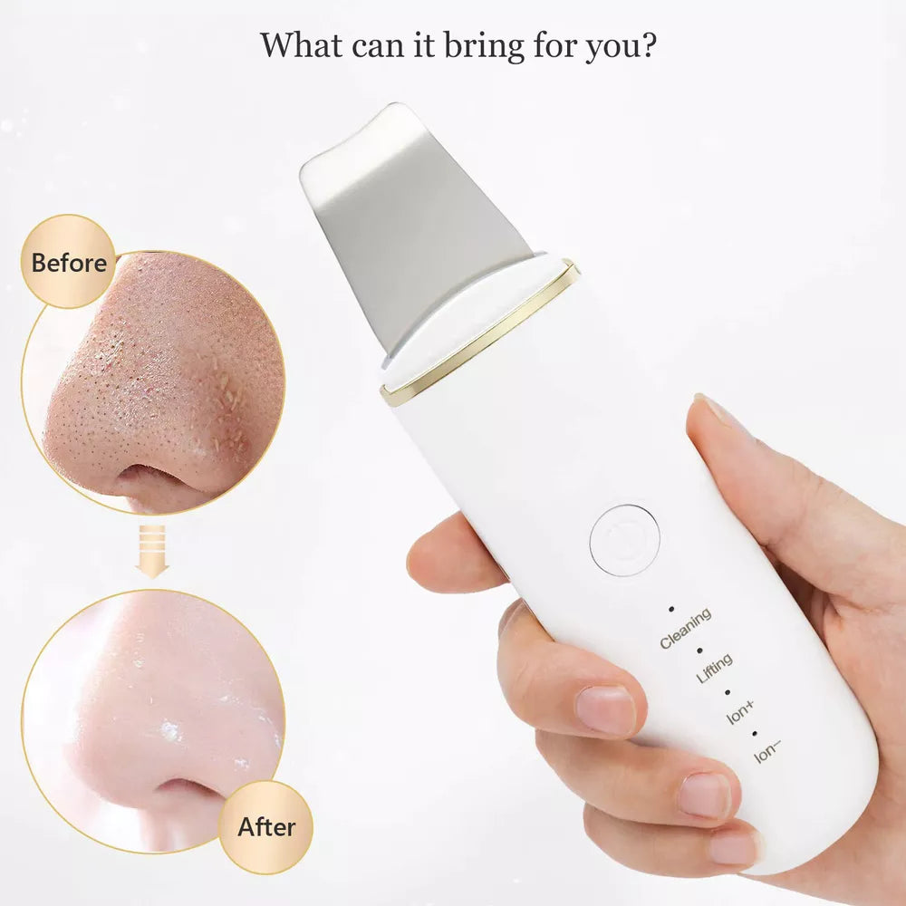 Ultrasonic Skin Scrubber Blackhead Remover – Deep Facial Cleansing & Exfoliation