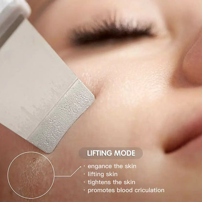 Ultrasonic Skin Scrubber Blackhead Remover – Deep Facial Cleansing & Exfoliation
