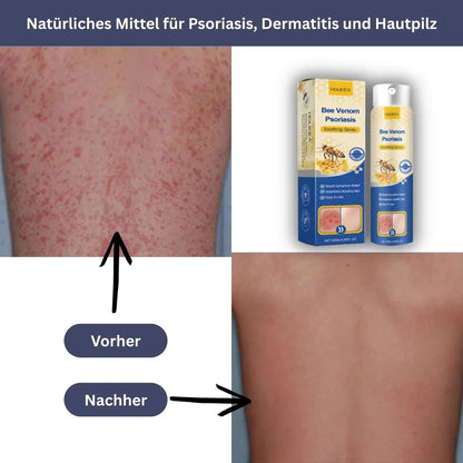 HOUKEA Bienengift Beruhigungsspray