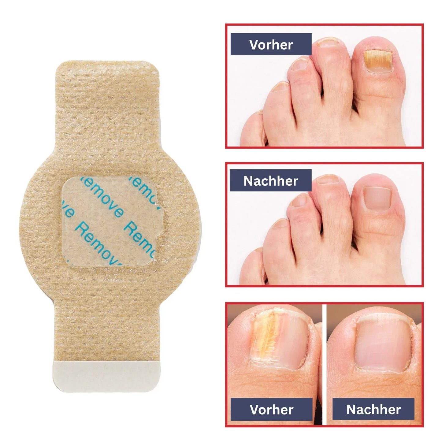 Nagelpflege Hydrogel-Patches