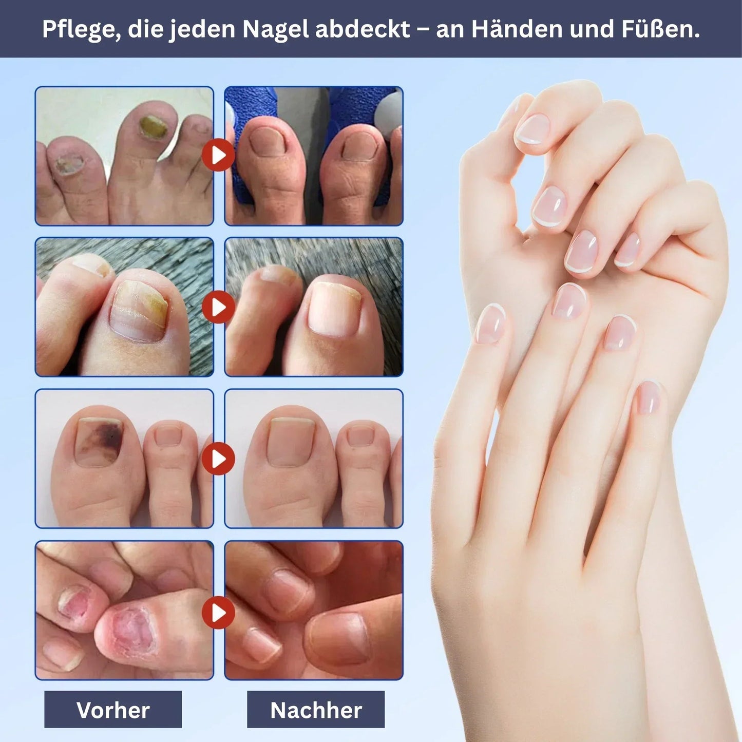 Nagelpflege Hydrogel-Patches