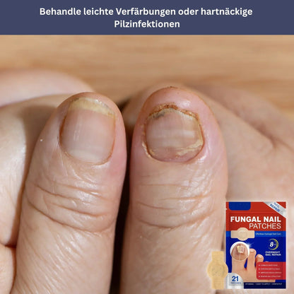 Nagelpflege Hydrogel-Patches