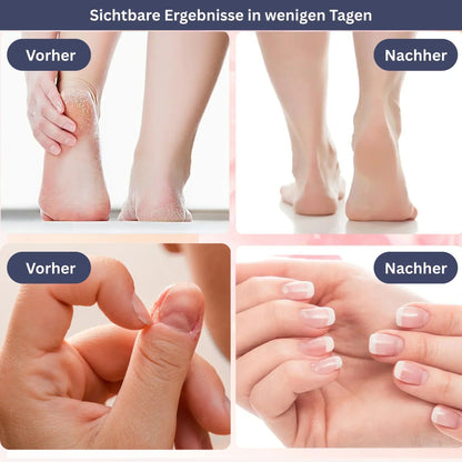 SamtFuß Pro – Elektrischer Hornhautentferner