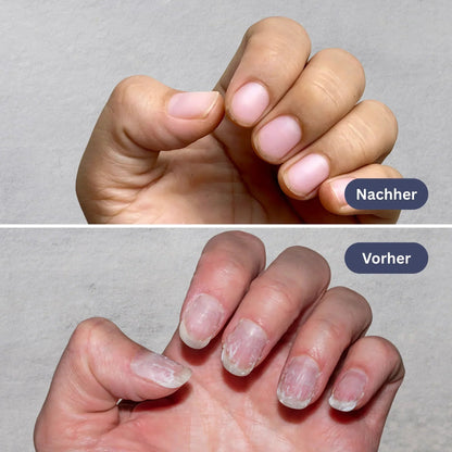 Natürlicher Nagelpflege-Stift – Intensivpflege für Nägel & Nagelhaut