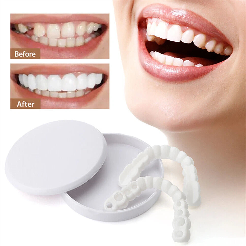 Clip On Veneers Fake Teeth Dental Covers Cosmetic Whitening