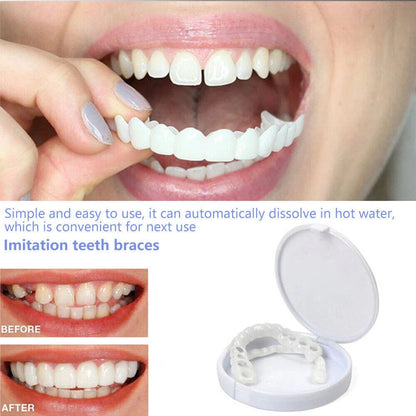Snap On Veneers Dental Covers False Teeth Upper Lower Adult